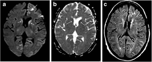 Fig. 5