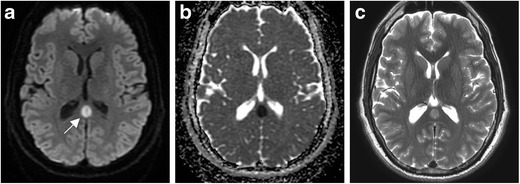 Fig. 9