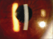 Figure 1a