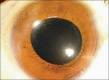 Figure 1c