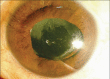 Figure 1d