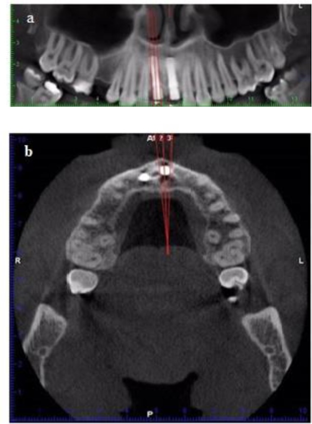 Fig. 1: