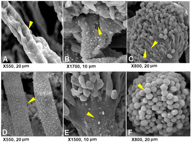 Figure 11