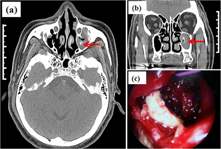 Fig 1