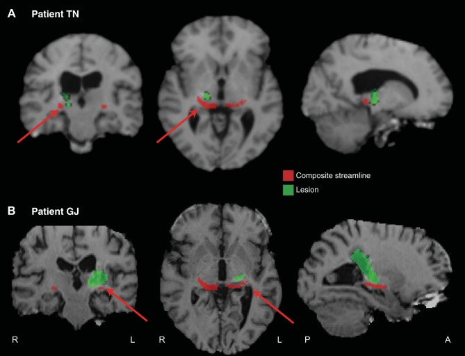 Fig. 12.