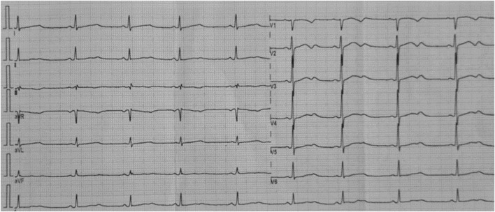 FIGURE 1