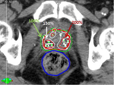 Fig. 7