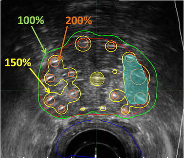 Fig. 6