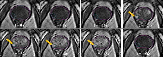 Fig. 3