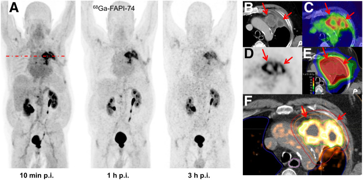 FIGURE 3.