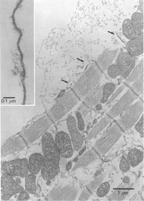 Fig. 18