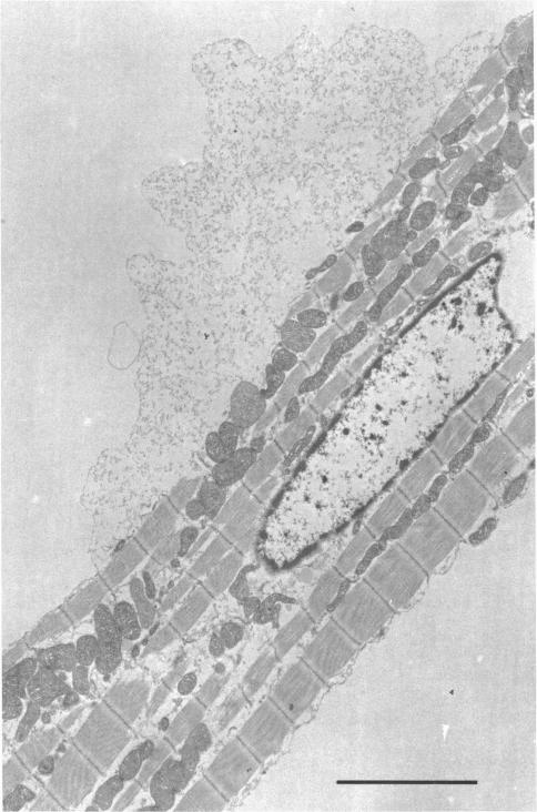 Fig. 17