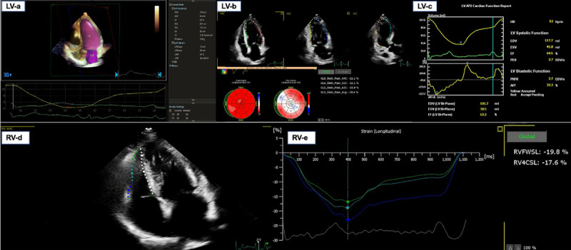 Left ventricle and right ventricle echocardiographic systolic analysis