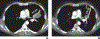 Fig. 2—