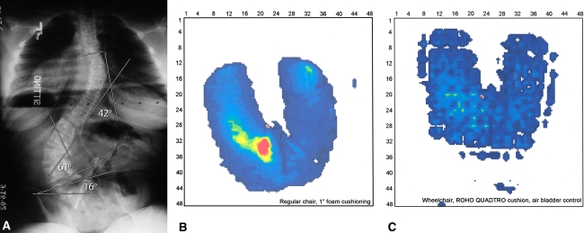 Fig. 1A–C