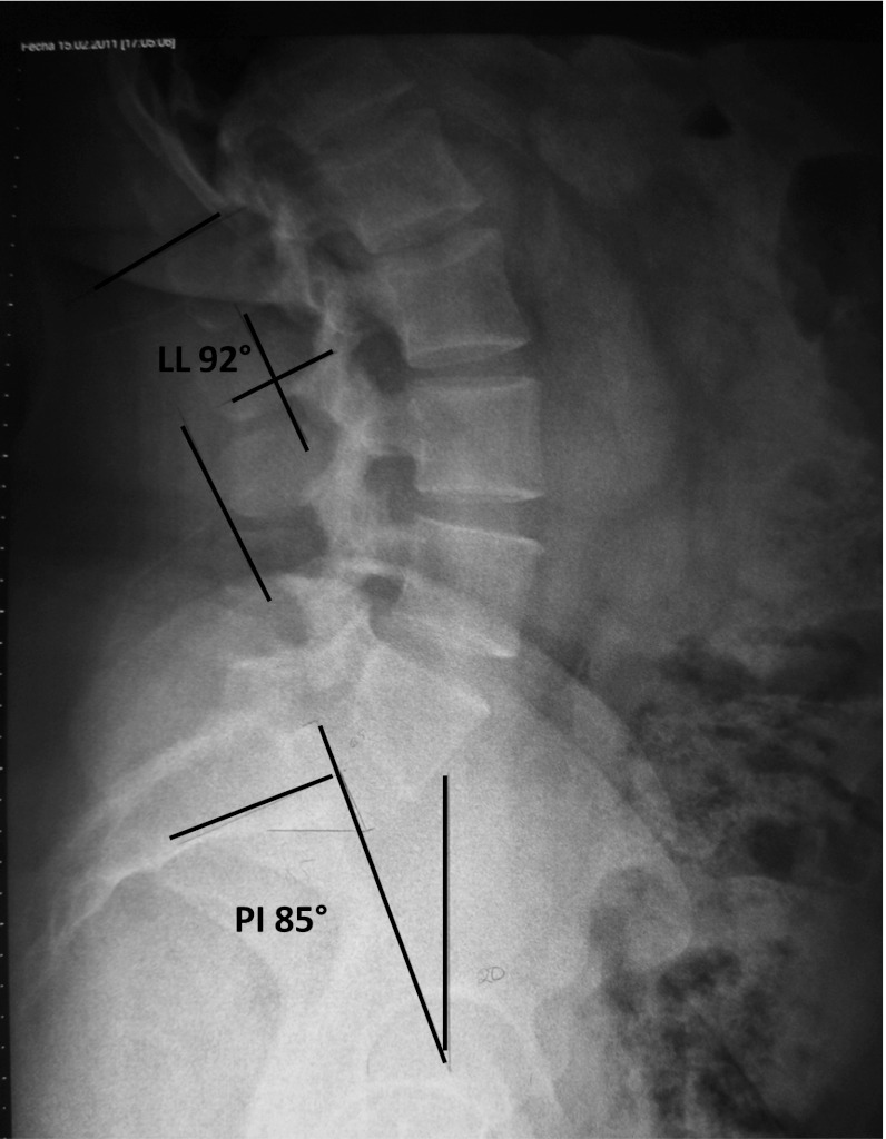 Fig. 2