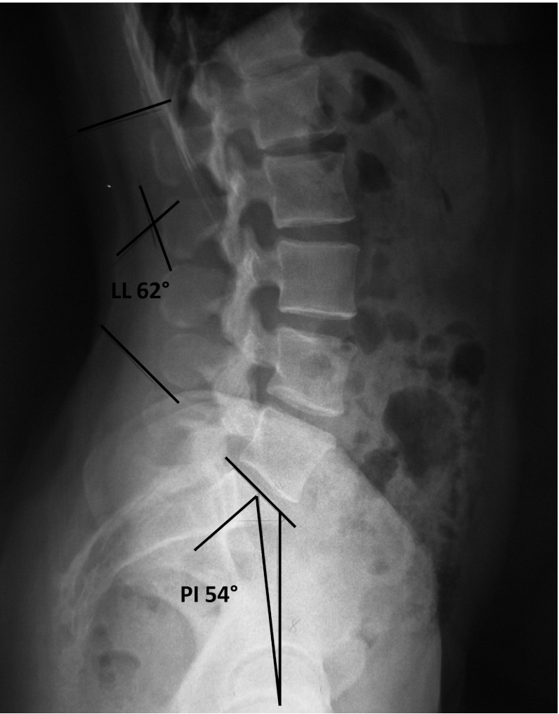 Fig. 1