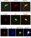 FIGURE 11.