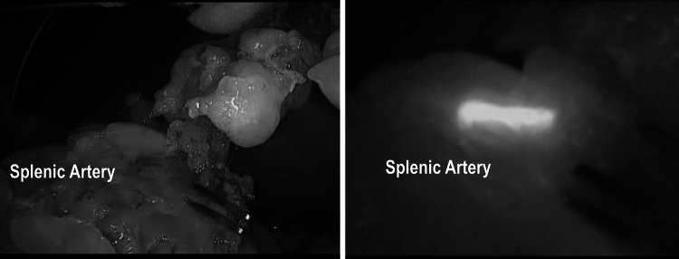 Fig. 11