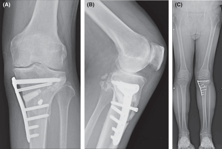 FIGURE 2