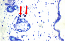 Fig. 14