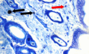 Fig. 17