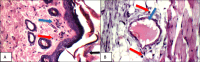 Fig. 11