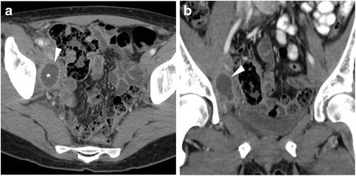 Fig. 5