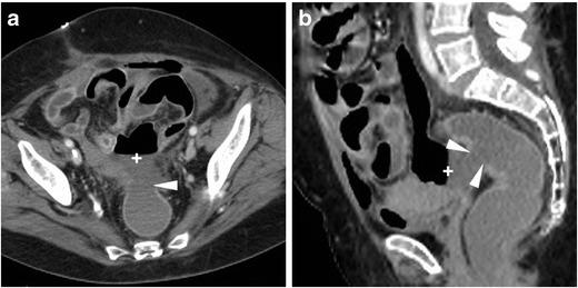 Fig. 11