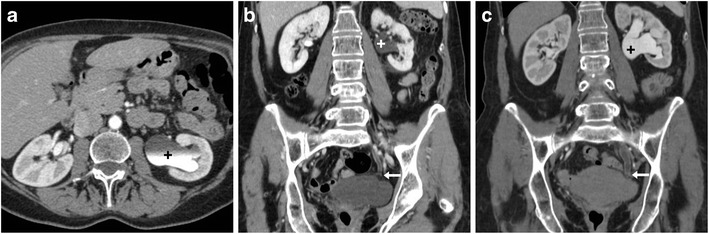 Fig. 15