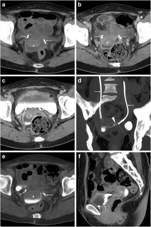 Fig. 13