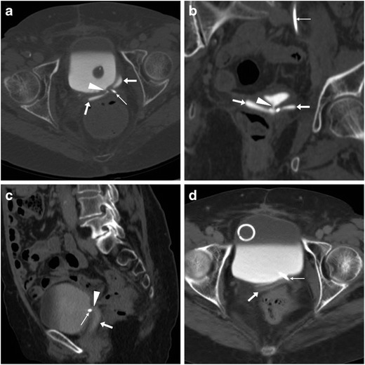 Fig. 17