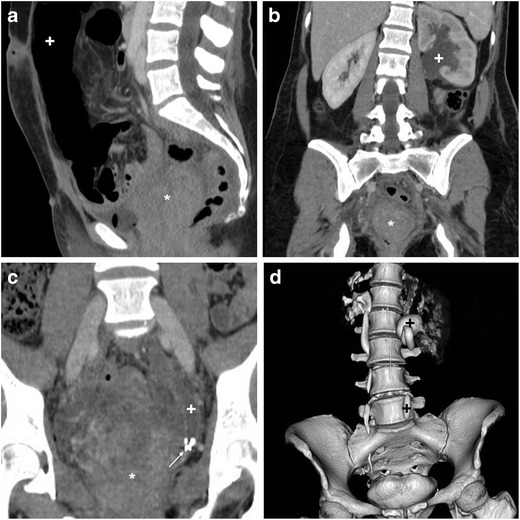 Fig. 14