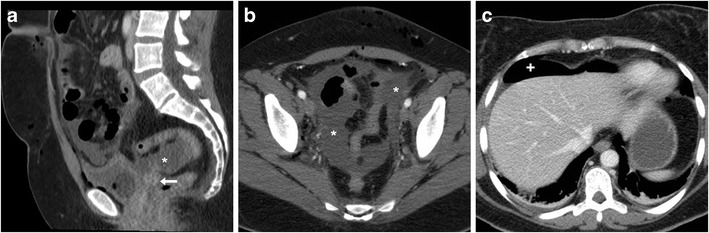 Fig. 10