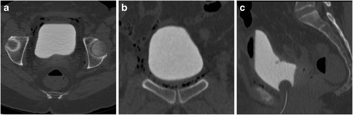 Fig. 16