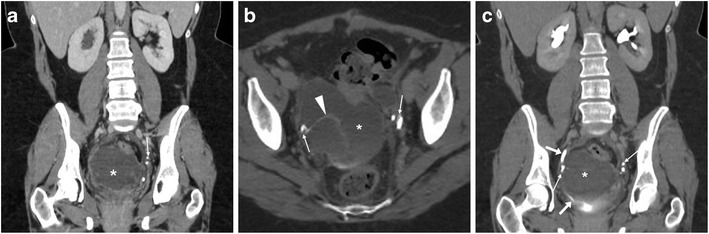 Fig. 12