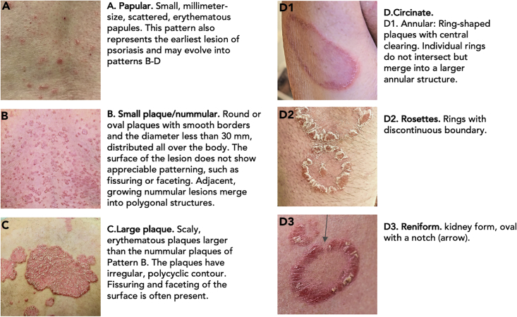 Figure 1