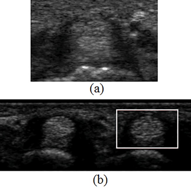 Fig 11