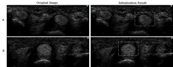 Fig 10