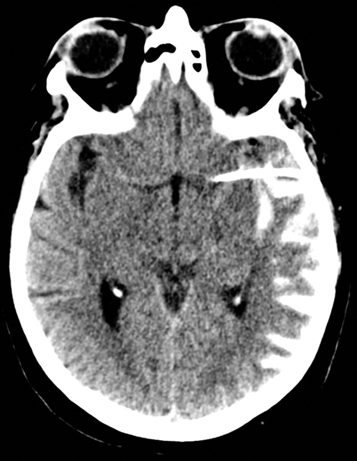 Fig 2.