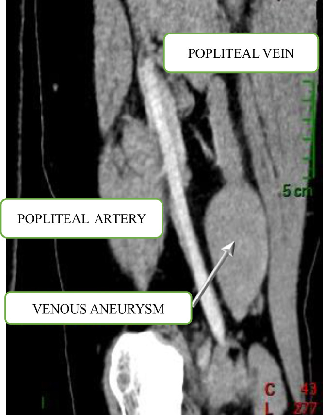 Fig 1: