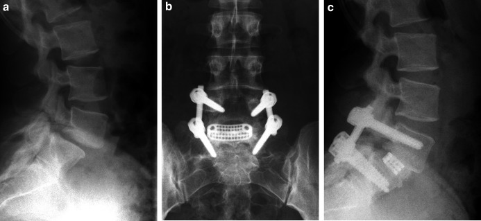 Fig. 3