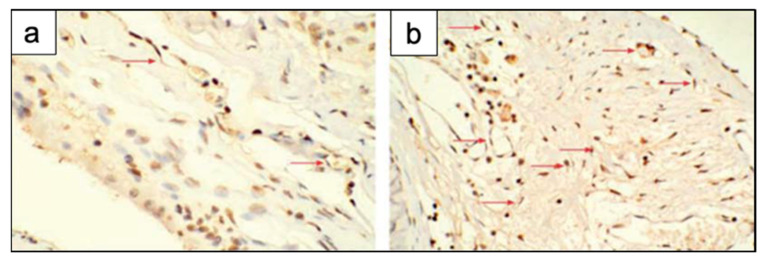 Figure 18