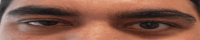 Fig 4: