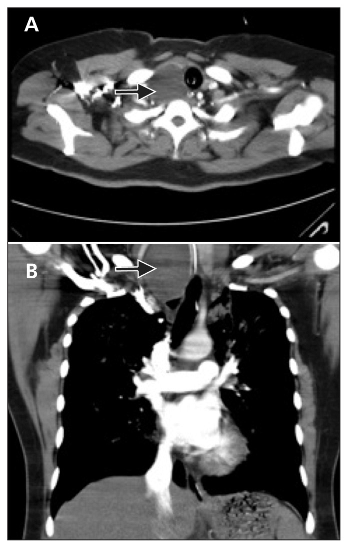 Figure 2: