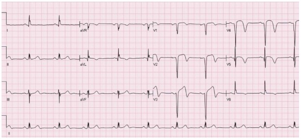 Figure 11