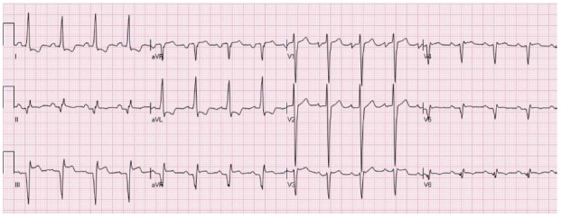 Figure 12