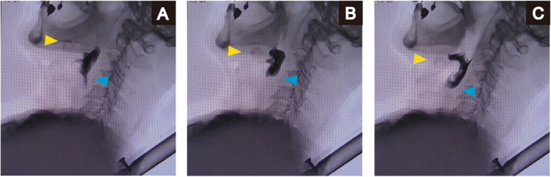 Fig. 2