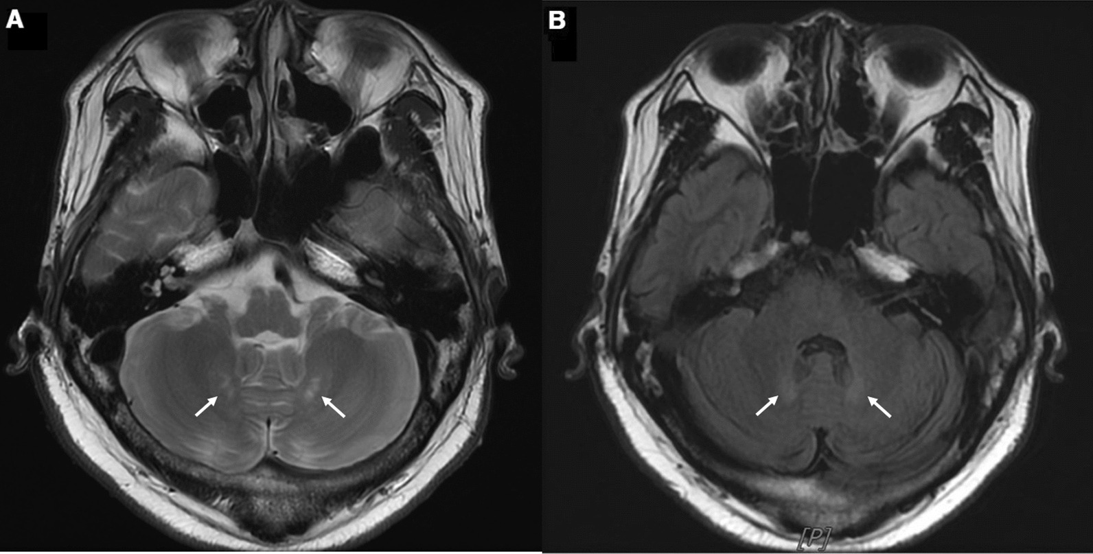 Fig. 2