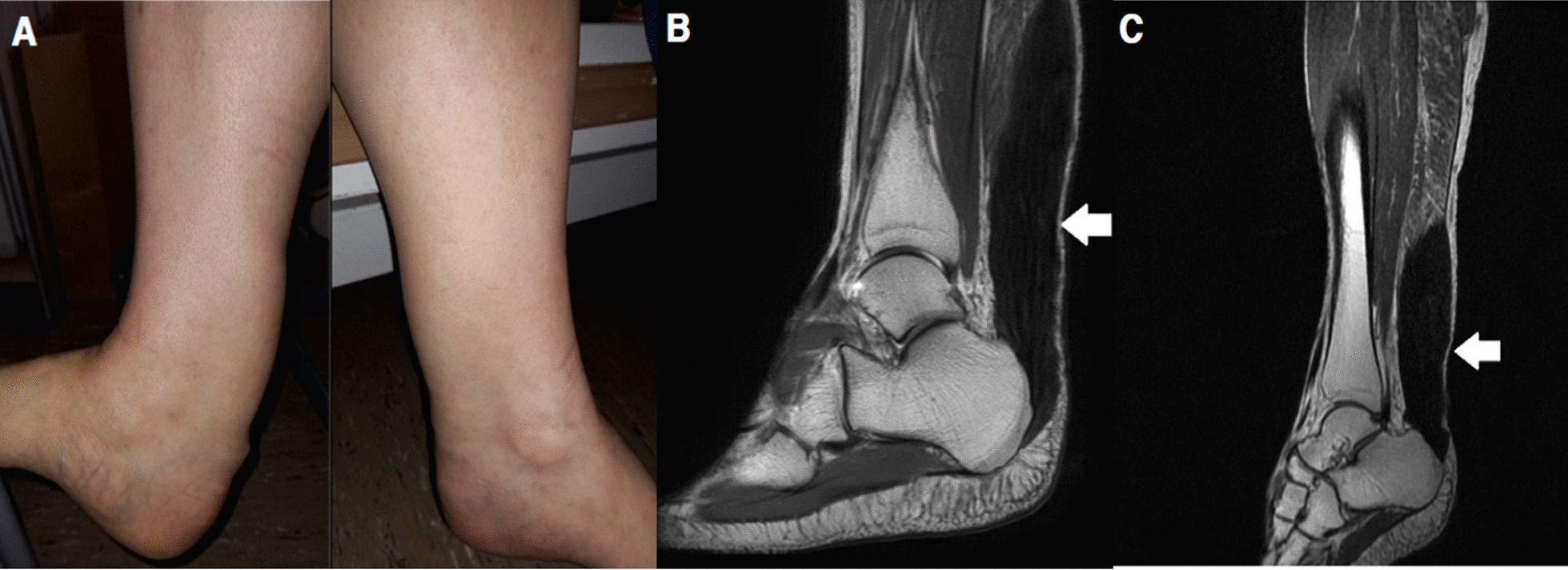 Fig. 1